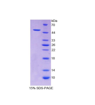 醛脱氢酶1家族成员A2(ALDH1A2)重组蛋白,Recombinant Aldehyde Dehydrogenase 1 Family, Member A2 (ALDH1A2)