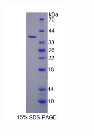 醛脫氫酶3家族成員A1(ALDH3A1)重組蛋白,Recombinant Aldehyde Dehydrogenase 3 Family, Member A1 (ALDH3A1)