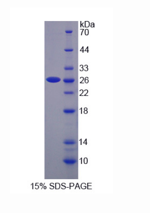 分拣连接蛋白17(SNX17)重组蛋白,Recombinant Sorting Nexin 17 (SNX17)