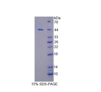 分拣连接蛋白9(SNX9)重组蛋白,Recombinant Sorting Nexin 9 (SNX9)