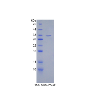 沉默調(diào)節(jié)蛋白3(SIRT3)重組蛋白,Recombinant Sirtuin 3 (SIRT3)