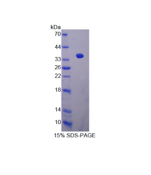 沉默调节蛋白4(SIRT4)重组蛋白,Recombinant Sirtuin 4 (SIRT4)