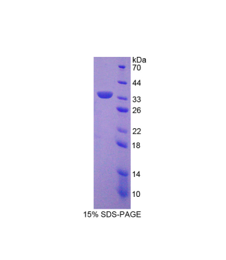 沉默调节蛋白5(SIRT5)重组蛋白,Recombinant Sirtuin 5 (SIRT5)