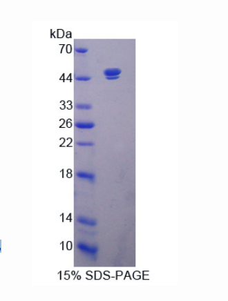 沉默调节蛋白7(SIRT7)重组蛋白,Recombinant Sirtuin 7 (SIRT7)