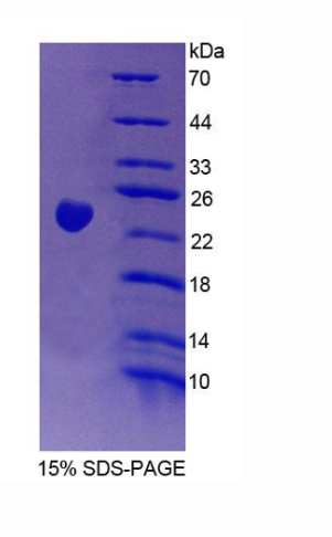 Vav3癌基因(VAV3)重组蛋白,Recombinant Vav 3 Oncogene (VAV3)