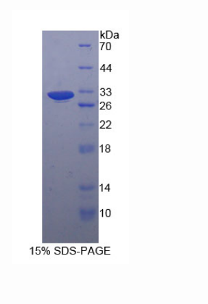 丝蛋白Bβ(FLNb)重组蛋白,Recombinant Filamin B Beta (FLNb)