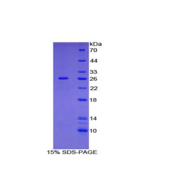 絲蛋白Cγ(FLNC)重組蛋白,Recombinant Filamin C Gamma (FLNC)