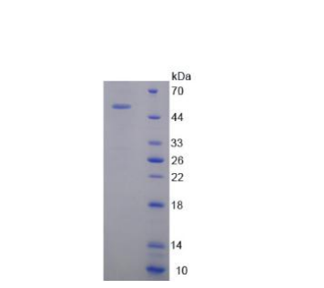 精氨酸/丝氨酸丰富剪接因子2(SRSF2)重组蛋白,Recombinant Serine/Arginine Rich Splicing Factor 2 (SRSF2)