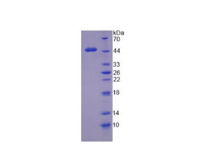 肾母细胞瘤蛋白1(WT1)重组蛋白,Recombinant Wilms Tumor Protein (WT1)