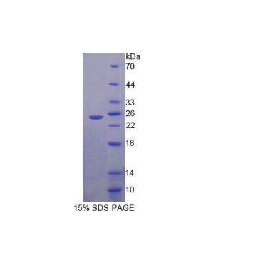 输出蛋白5(XPO5)重组蛋白,Recombinant Exportin 5 (XPO5)