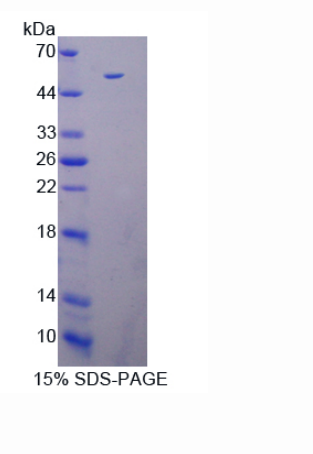 死亡关联蛋白激酶3(DAPK3)重组蛋白,Recombinant Death Associated Protein Kinase 3 (DAPK3)