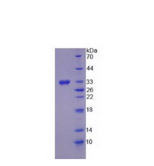 17-β-羟基类固醇脱氢酶3(HSD17b3)重组蛋白,Recombinant 17-Beta-Hydroxysteroid Dehydrogenase Type 3 (HSD17b3)