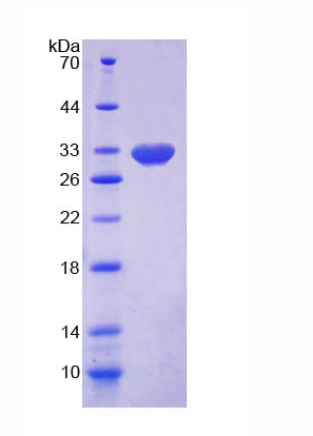 17-β-羟基类固醇脱氢酶14(HSD17b14)重组蛋白,Recombinant 17-Beta-Hydroxysteroid Dehydrogenase Type 14 (HSD17b14)