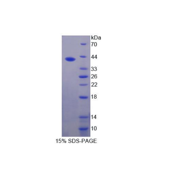 岩藻糖基转移酶6(FUT6)重组蛋白,Recombinant Fucosyltransferase 6 (FUT6)