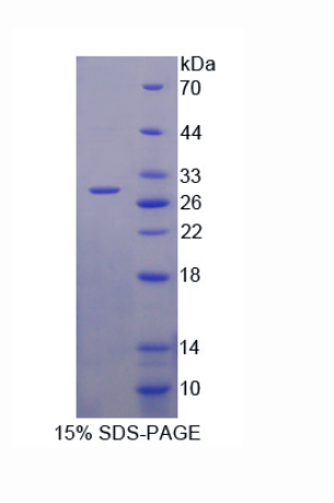 腺苷酸激酶3(AK3)重组蛋白,Recombinant Adenylate Kinase 3 (AK3)