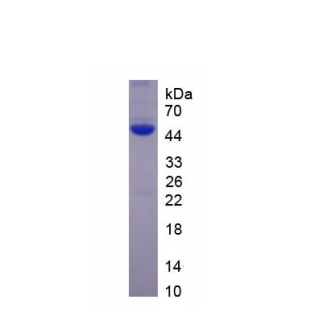 L-型電壓依賴性鈣離子通道α1D亞基(CACNa1D)重組蛋白,Recombinant Calcium Channel, Voltage Dependent, L-Type, Alpha 1D Subunit (CACNa1D)