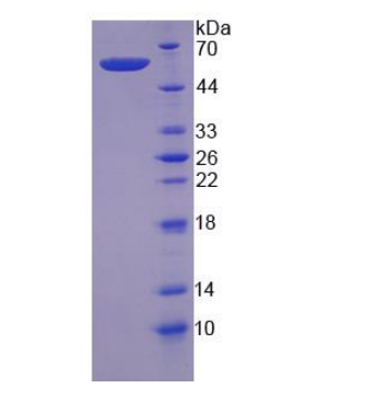 钙蛋白酶6(CAPN6)重组蛋白,Recombinant Calpain 6 (CAPN6)