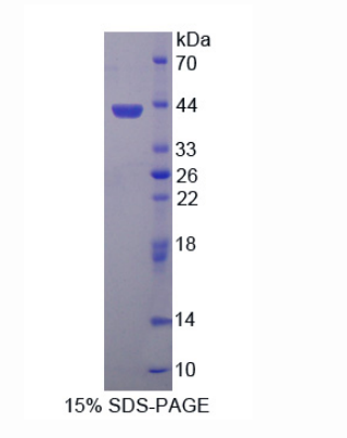 羰基还原酶3(CBR3)重组蛋白,Recombinant Carbonyl Reductase 3 (CBR3)