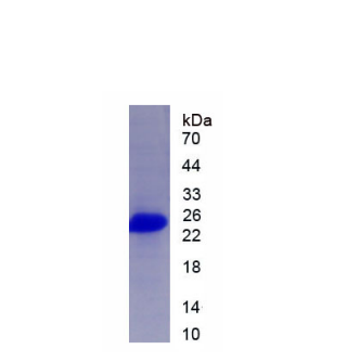 封閉蛋白2(CLDN2)重組蛋白,Recombinant Claudin 2 (CLDN2)