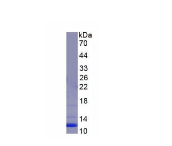 封闭蛋白3(CLDN3)重组蛋白,Recombinant Claudin 3 (CLDN3)