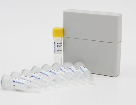 鹦鹉热嗜衣原体染料法荧光定量PCR试剂盒,Chlamydophila psittaci