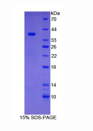 羧肽酶B1(CPB1)重組蛋白,Recombinant Carboxypeptidase B1, Tissue (CPB1)