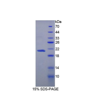 羧肽酶N1(CPN1)重组蛋白,Recombinant Carboxypeptidase N1 (CPN1)