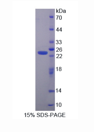 半胱氨酸甘氨酸丰富蛋白1(CSRP1)重组蛋白,Recombinant Cysteine And Glycine Rich Protein 1 (CSRP1)