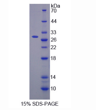 半胱氨酸丰富分泌蛋白3(CRISP3)重组蛋白,Recombinant Cysteine Rich Secretory Protein 3 (CRISP3)