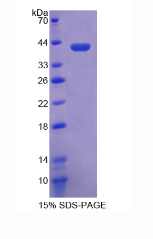 晶状体蛋白λ1(CRYl1)重组蛋白,Recombinant Crystallin Lambda 1 (CRYl1)