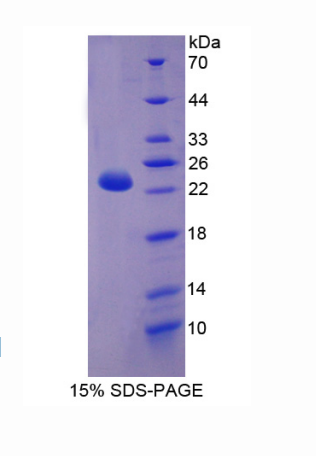 肉毒碱棕榈酰基转移酶1B(CPT1B)重组蛋白,Recombinant Carnitine Palmitoyltransferase 1B, Muscle (CPT1B)