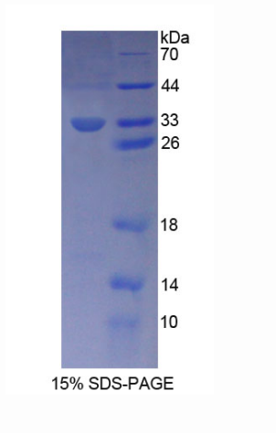 異連蛋白β(DTNb)重組蛋白,Recombinant Dystrobrevin Beta (DTNb)