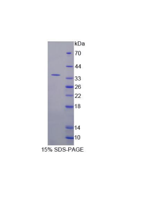 二肽酶3(DPEP3)重组蛋白,Recombinant Dipeptidase 3 (DPEP3)