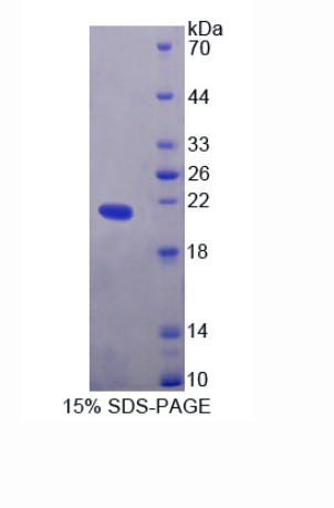 内皮素2(EDN2)重组蛋白,Recombinant Endothelin 2 (EDN2)