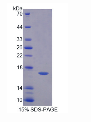 脂肪酸去飽和酶3(FADS3)重組蛋白,Recombinant Fatty Acid Desaturase 3 (FADS3)