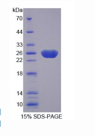 衰老关键蛋白3(FBLN3)重组蛋白,Recombinant Fibulin 3 (FBLN3)