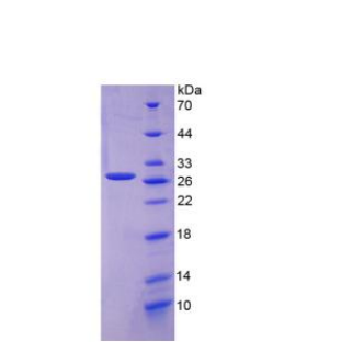 叶酸受体1(FOLR1)重组蛋白,Recombinant Folate Receptor 1, Adult (FOLR1)