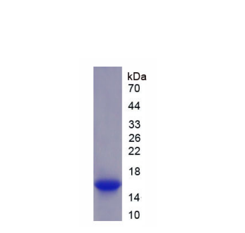 透明质酸合酶2(HAS2)重组蛋白,Recombinant Hyaluronan Synthase 2 (HAS2)