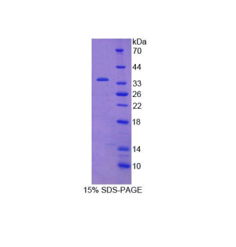 Janus激酶2(JAK2)重组蛋白,Recombinant Janus Kinase 2 (JAK2)