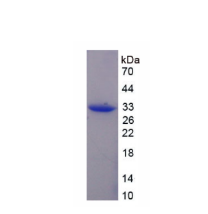 驱动蛋白家族成员1A(KIF1A)重组蛋白,Recombinant Kinesin Family, Member 1A (KIF1A)