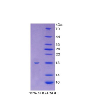 驱动蛋白家族成员5A(KIF5A)重组蛋白,Recombinant Kinesin Family, Member 5A (KIF5A)