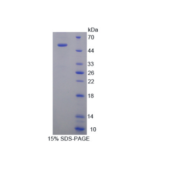 驱动蛋白家族成员18A(KIF18A)重组蛋白,Recombinant Kinesin Family, Member 18A (KIF18A)