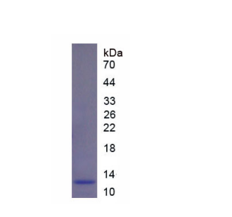 吻素受體(KISS1R)重組蛋白,Recombinant Kisspeptin Receptor (KISS1R)