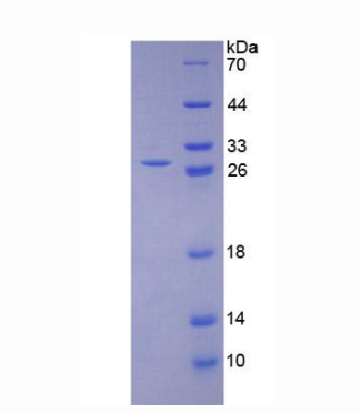 赖氨酰氧化酶样蛋白1(LOXL1)重组蛋白,Recombinant Lysyl Oxidase Like Protein 1 (LOXL1)