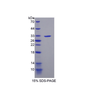 赖氨酰氧化酶样蛋白4(LOXL4)重组蛋白,Recombinant Lysyl Oxidase Like Protein 4 (LOXL4)