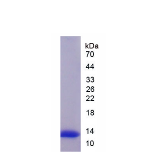 线粒体解偶联蛋白1(UCP1)重组蛋白,Recombinant Uncoupling Protein 1, Mitochondrial (UCP1)