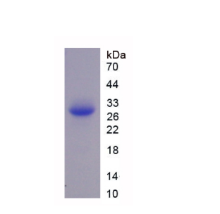 多聚蛋白2(MMRN2)重組蛋白,Recombinant Multimerin 2 (MMRN2)