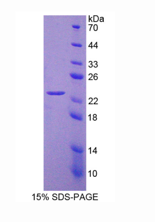 肌微管素相关蛋白9(MTMR9)重组蛋白,Recombinant Myotubularin Related Protein 9 (MTMR9)