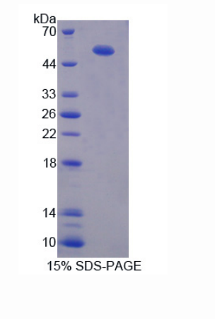 腱蛋白樣蛋白1(CHRDL1)重組蛋白,Recombinant Chordin Like Protein 1 (CHRDL1)