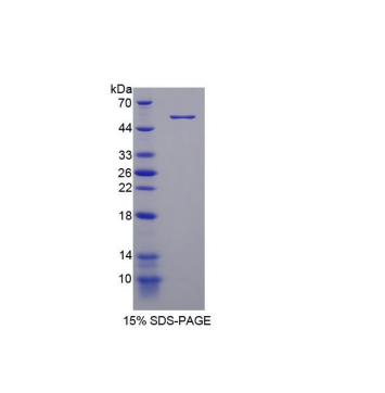 磷酸二酯酶4D(PDE4D)重组蛋白,Recombinant Phosphodiesterase 4D, cAMP Specific (PDE4D)